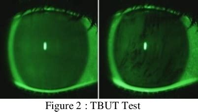 tear film instability test|test for tear film stability.